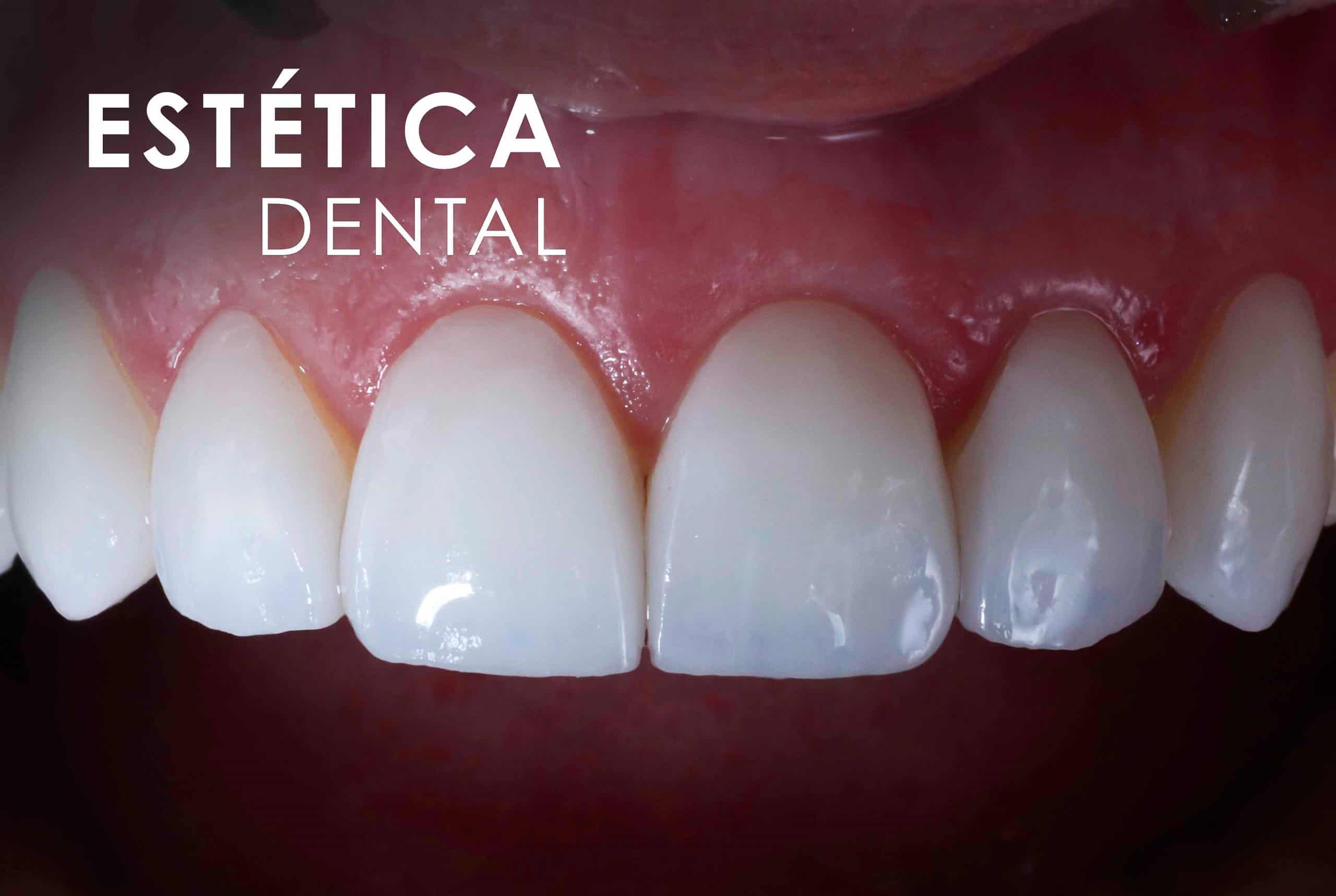 Estética Dental Clínica Dental Bernabeu