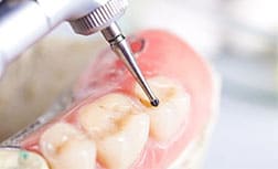 qué es la endodoncia