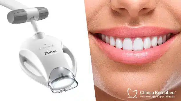 Un sesión Blanqueamiento