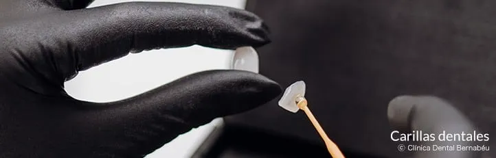 diferencias carillas y fundas