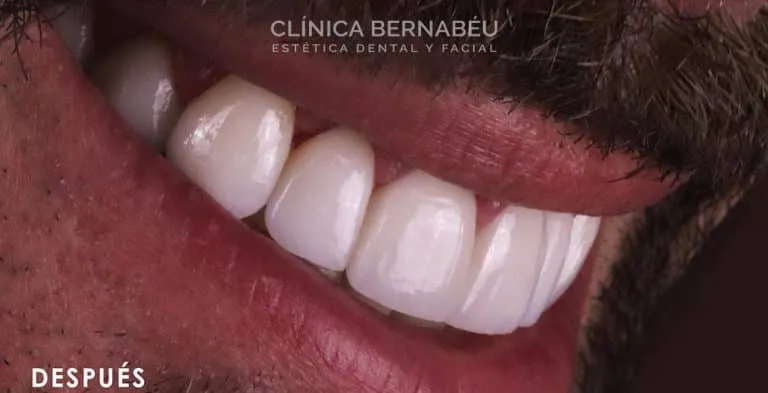 Dientes sonrisa Juan faro