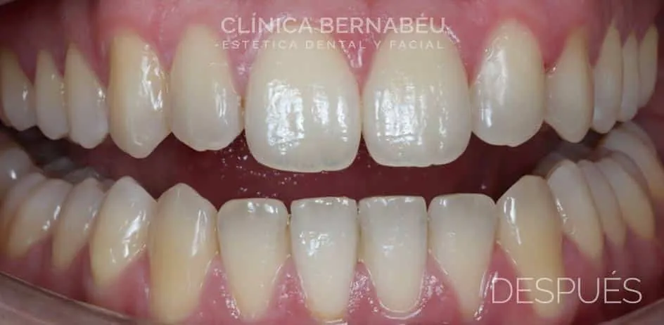 Clínica ortodoncia Madrid