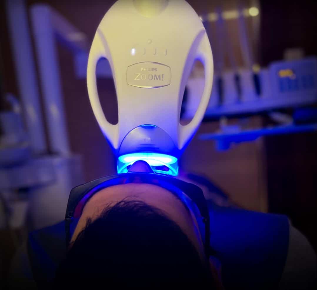 Blanqueamiento dental Zoom WhiteSpeed de Philips