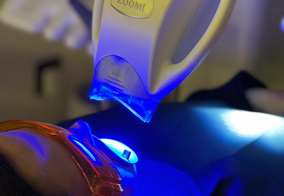 Foto de blanqueamiento led y su precio