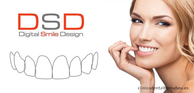 Diseño Digital de Sonrisa (DSD) en Clínica Dental Bernabéu Madrid