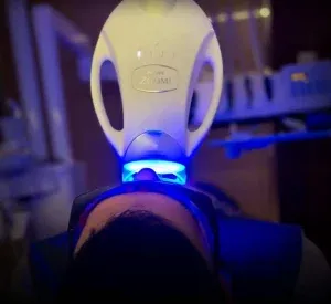 Paciente durante sesión de blanqueamiento con lámpara Zoom WhiteSpeed activada en Clínica Dental Bernabéu