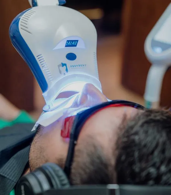Lámpara LED de blanqueamiento con el temporizador corriendo sobre un paciente con gafas de protección