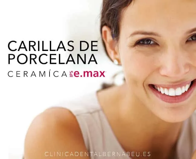 Carillas de porcelana cerámica E-max en Madrid